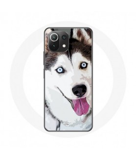 Coque pour Xiaomi Mi 11...