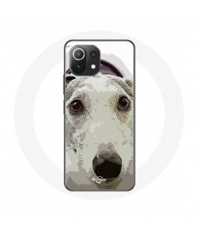 Coque pour Xiaomi Mi 11...