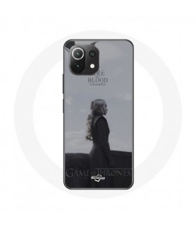 Coque pour Xiaomi Mi 11...