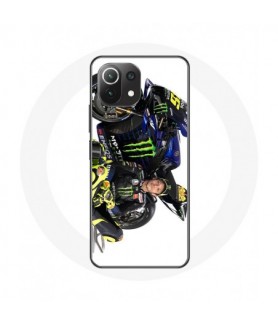 Coque pour Xiaomi Mi 11...