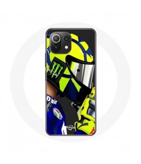 Coque pour Xiaomi Mi 11...