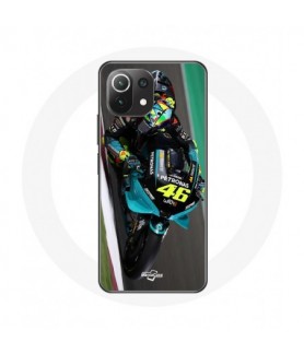 Coque pour Xiaomi Mi 11...