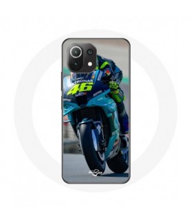 Coque pour Xiaomi Mi 11...