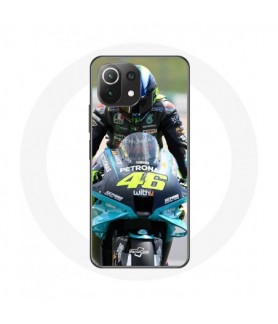 Coque pour Xiaomi Mi 11...